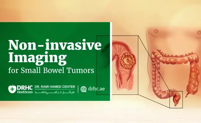 Non-invasive Imaging for Small Bowel Tumors