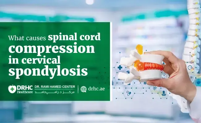 What causes spinal cord compression in cervical spondylosis