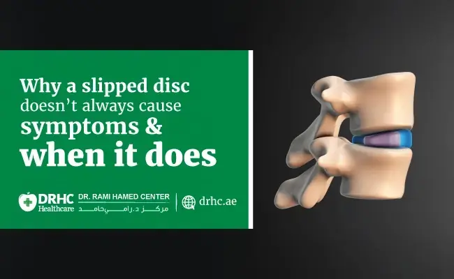 Why a slipped disc doesn’t always cause symptoms — and when it does