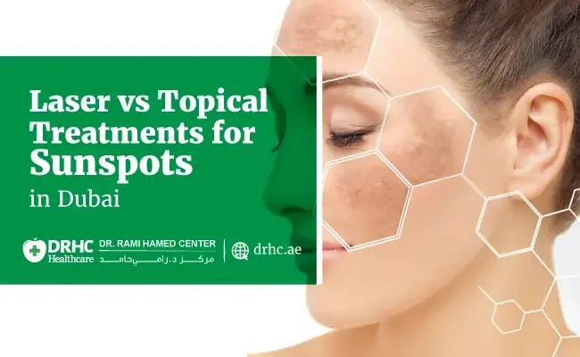 Laser vs Topical Treatments for Sunspots in Dubai