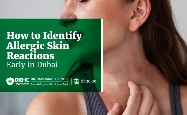 How to Identify Allergic Skin Reactions Early in Dubai
