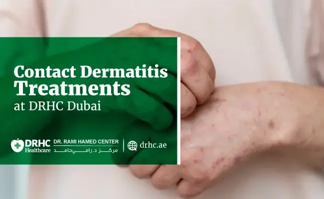 Contact Dermatitis Treatments at DRHC Dubai