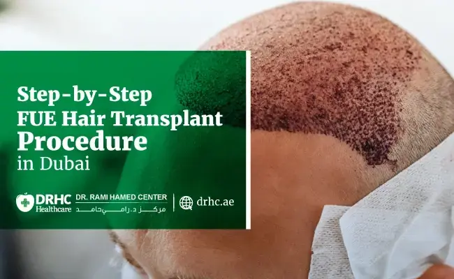 Step-by-Step FUE Hair Transplant Procedure in Dubai