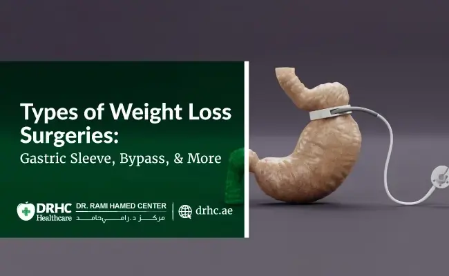 Types of Weight Loss Surgeries: Gastric Sleeve, Bypass, and More