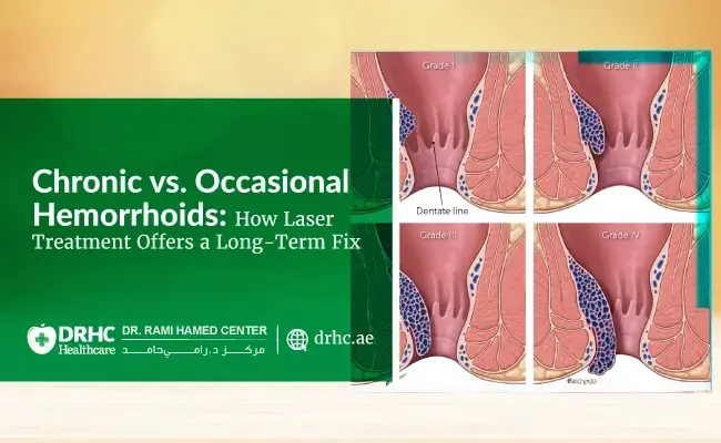 Chronic vs. Occasional Hemorrhoids: How Laser Treatment Offers a Long-Term Fix
