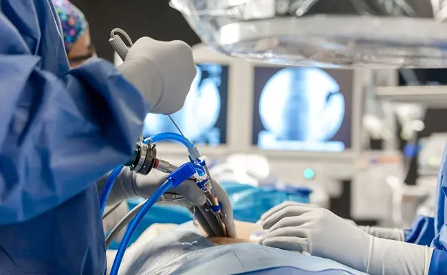 جراحة العمود الفقري بالمنظار: مفتاح تقليل الألم إلى أدنى حد وتسريع التعافي إلى أقصى حد