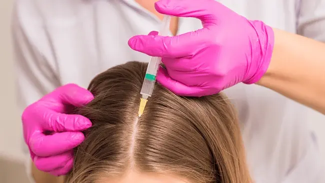 Exosome Therapy for Hair Loss: The Future of Hair Regeneration in Dubai