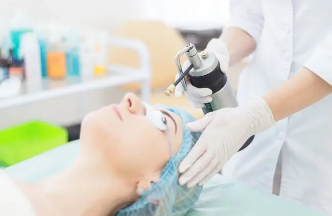 How Many Cryotherapy Sessions Are Needed for Viral Skin Lesions?