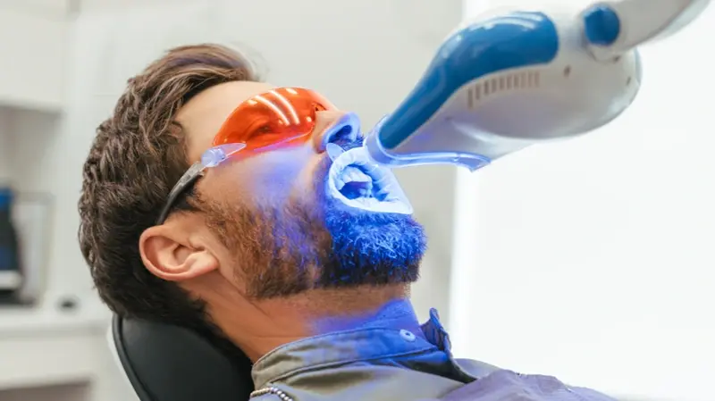 Laser Teeth Whitening: How to Get a Brighter Smile in One Session