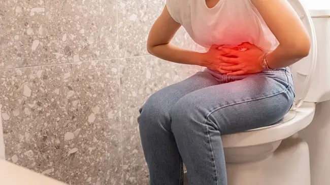 Persistent Changes in Bowel Habits: When Should You Consider Colonoscopy?