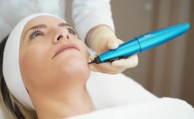 Skin Cryotherapy in Dubai: Conditions Treated, Success Rates & What to Expect