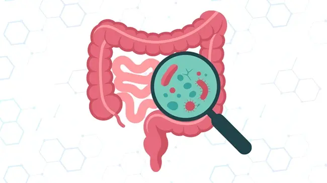 What Can a Colonoscopy Detect?