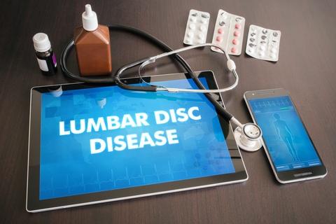 When to decide to operate on Lumbar Disc Prolapse?
